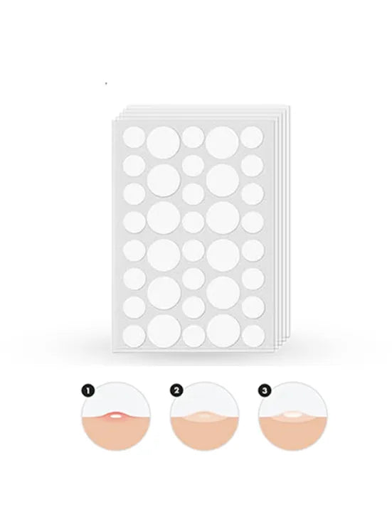 Glamorous Face Acne Pimple Patch 72 Patches
