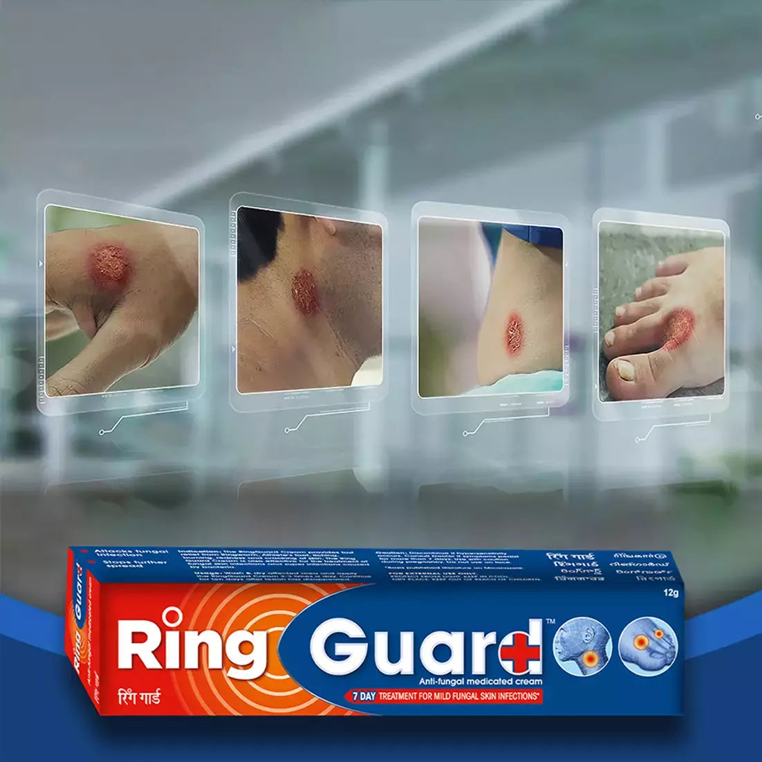 Ring Guard Anti Fungal Cream Tube Of 12gm