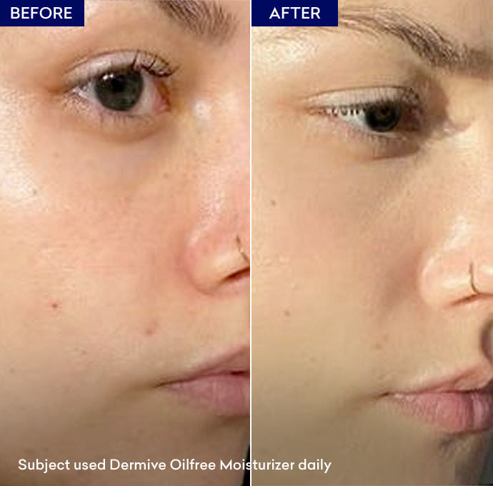 Dermive Oil Free Calms & Soothes | Light-Weight